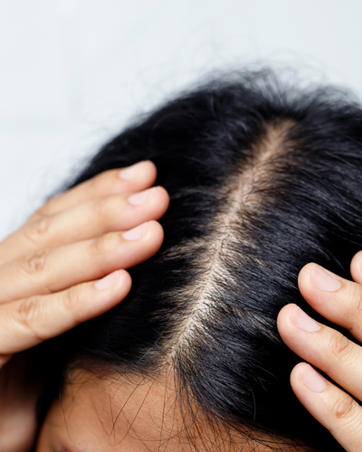 10 Expert Tips for a Dry &amp; Itchy Scalp