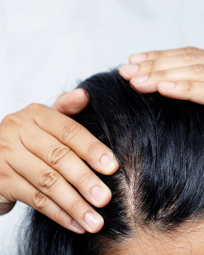 10 Expert Tips to Treat and Prevent Product Build-Up