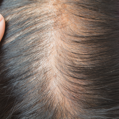 Why is my hair falling out? Lets get to the root of the cause!